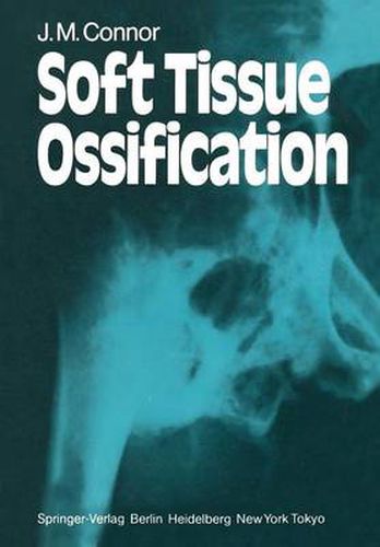 Cover image for Soft Tissue Ossification