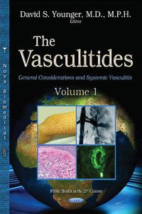 Cover image for Vasculitides: Volume 1 -- General Considerations & Systemic Vasculitis