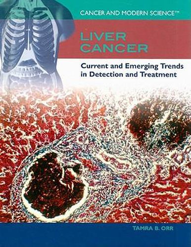 Cover image for Liver Cancer: Current and Emerging Trends in Detection and Treatment