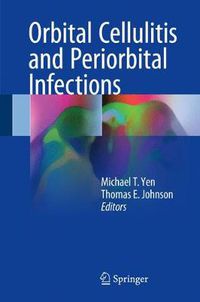 Cover image for Orbital Cellulitis and Periorbital Infections