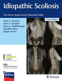 Cover image for Idiopathic Scoliosis: The Harms Study Group Treatment Guide