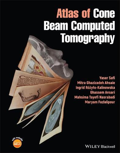 Cover image for Atlas of Cone Beam Computed Tomography