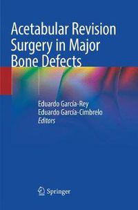Cover image for Acetabular Revision Surgery in Major Bone Defects