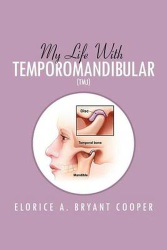 Cover image for My Life with Temporomandibular (Tmj): Living with Tmj