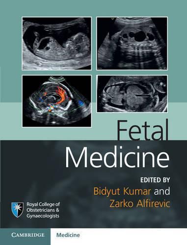 Cover image for Fetal Medicine