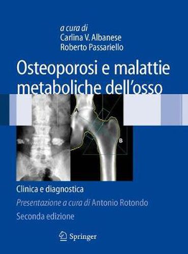 Cover image for Osteoporosi e malattie metaboliche dell'osso: Clinica e diagnostica