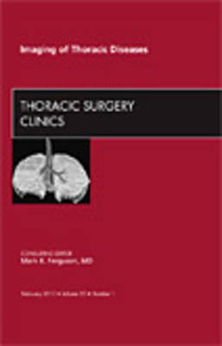 Cover image for Imaging of Thoracic Diseases, An Issue of Thoracic Surgery Clinics