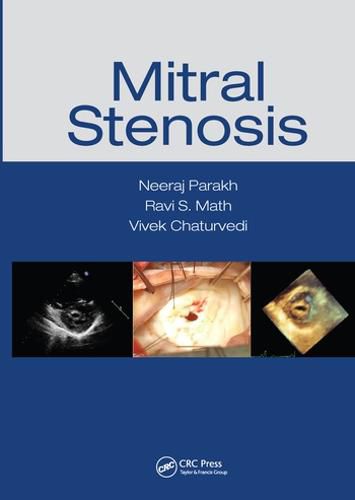 Cover image for Mitral Stenosis