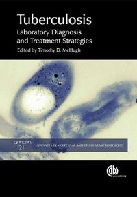 Cover image for Tuberculosis: Laboratory Diagnosis and Treatment Strategies