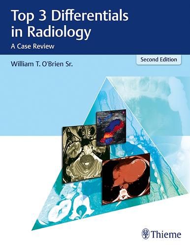 Cover image for Top 3 Differentials in Radiology: A Case Review