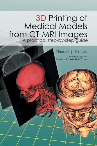 Cover image for 3D Printing of Medical Models from CT-MRI Images: A Practical step-by-step guide