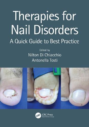 Cover image for Therapies for Nail Disorders: A Quick Guide to Best Practice