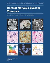 Cover image for WHO classification of tumours of the central nervous system