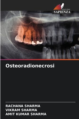 Cover image for Osteoradionecrosi