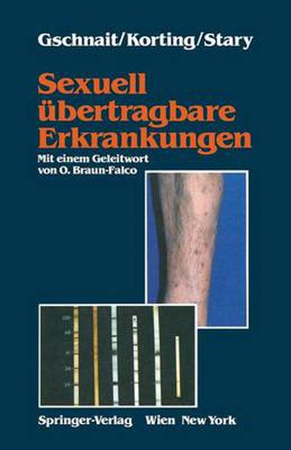 Cover image for Sexuell UEbertragbare Erkrankungen