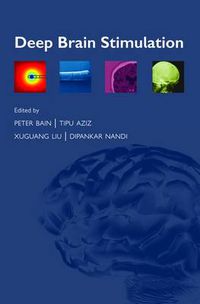 Cover image for Deep Brain Stimulation