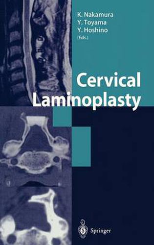 Cover image for Cervical Laminoplasty