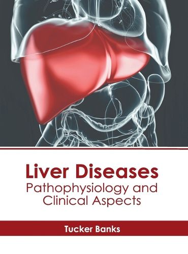 Cover image for Liver Diseases: Pathophysiology and Clinical Aspects