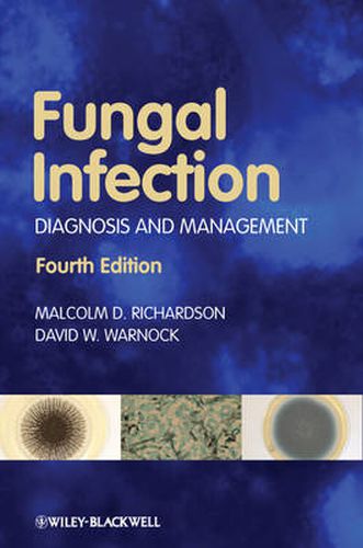 Cover image for Fungal Infection: Diagnosis and Management