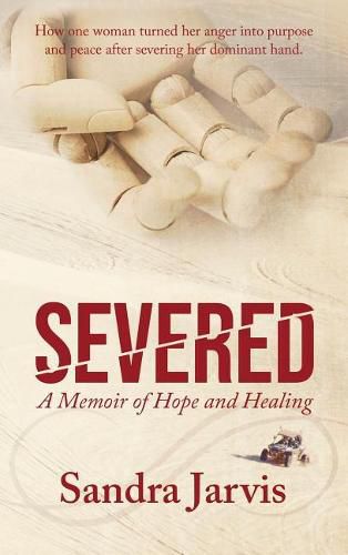 Cover image for Severed: A Memoir of Hope and Healing