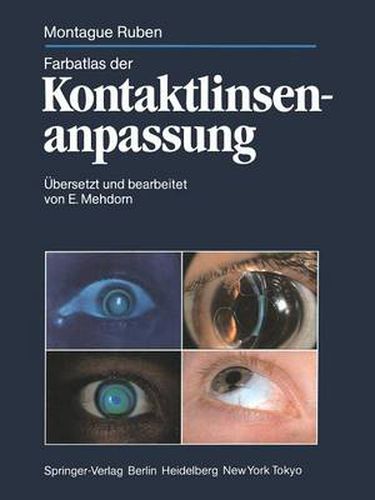 Cover image for Farbatlas der Kontaktlinsenanpassung