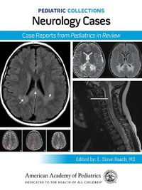 Cover image for Neurology Cases