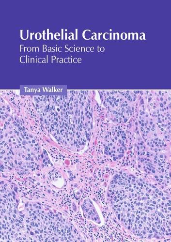 Cover image for Urothelial Carcinoma: From Basic Science to Clinical Practice