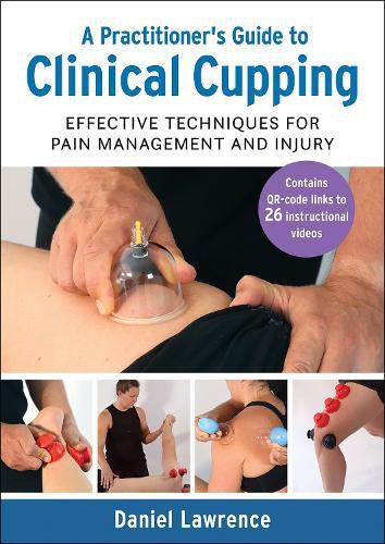 Cover image for A Practitioner's Guide to Clinical Cupping