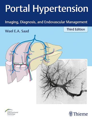 Cover image for Portal Hypertension: Imaging, Diagnosis, and Endovascular Management