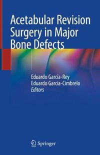 Cover image for Acetabular Revision Surgery in Major Bone Defects