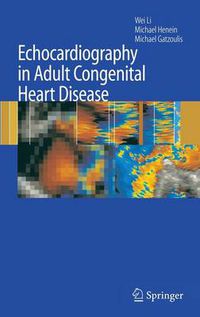 Cover image for Echocardiography in Adult Congenital Heart Disease