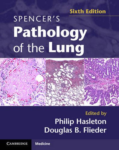 Cover image for Spencer's Pathology of the Lung 2 Part Set with DVDs