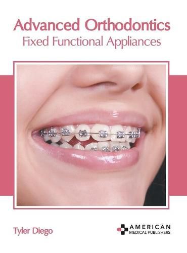 Cover image for Advanced Orthodontics: Fixed Functional Appliances