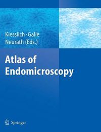 Cover image for Atlas of Endomicroscopy