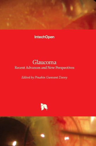 Cover image for Glaucoma