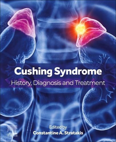 Cover image for Cushing Syndrome