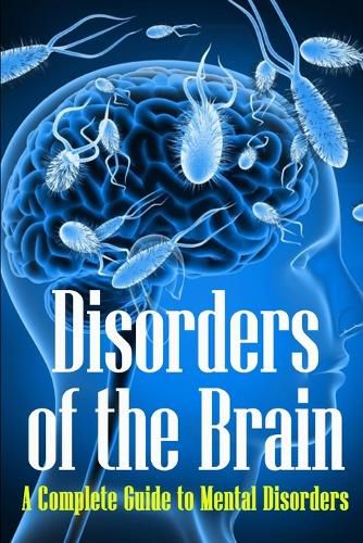 Cover image for Disorders of the Brain