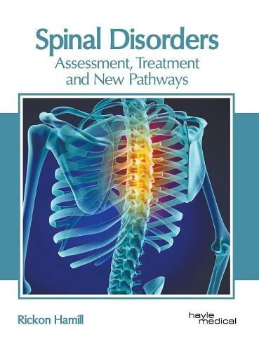 Cover image for Spinal Disorders: Assessment, Treatment and New Pathways