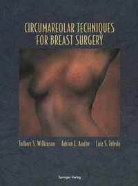 Cover image for Circumareolar Techniques for Breast Surgery