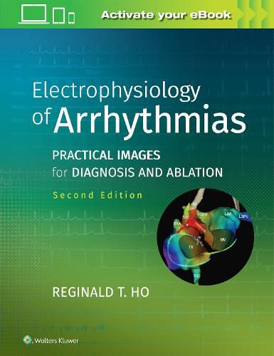 Cover image for Electrophysiology of Arrhythmias: Practical Images for Diagnosis and Ablation