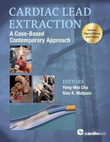Cover image for Cardiac Lead Extraction: A Case-Based Contemporary Approach