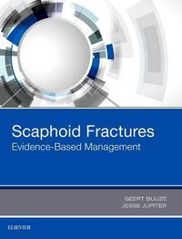 Cover image for Scaphoid Fractures: Evidence-Based Management