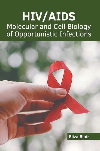 Cover image for Hiv/Aids: Molecular and Cell Biology of Opportunistic Infections