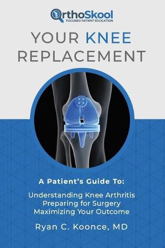 Cover image for Your Knee Replacement: A Patient's Guide To: Understanding Knee Arthritis, Preparing for Surgery, Maximizing Your Outcome