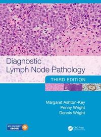 Cover image for Diagnostic Lymph Node Pathology