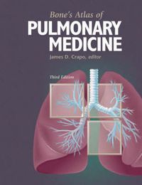 Cover image for Bone's Atlas of Pulmonary Medicine