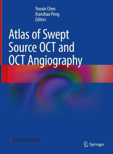 Cover image for Atlas of Swept Source OCT and OCT Angiography