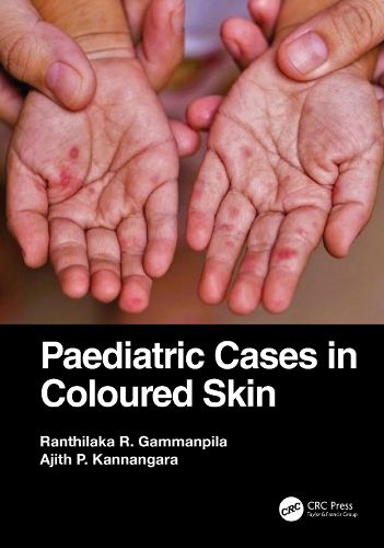 Cover image for Paediatric Cases in Coloured Skin