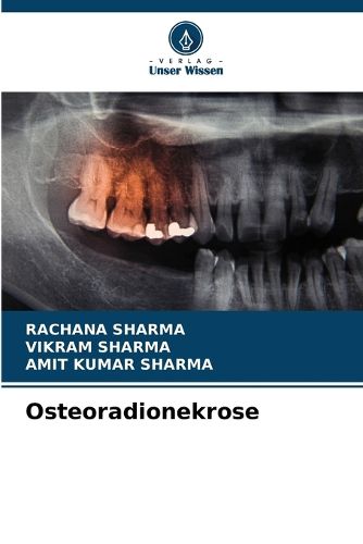 Cover image for Osteoradionekrose