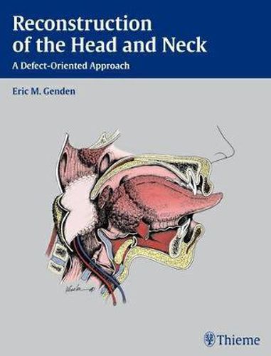 Cover image for Reconstruction of the Head and Neck: A Defect-Oriented Approach